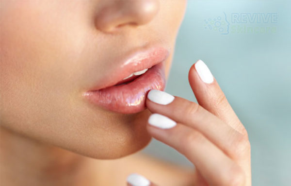 Lip Fillers vs a Botox Lip Flip post thumbnail